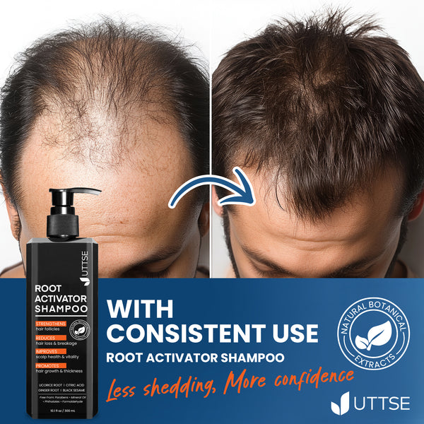 Root Activator Shampoo for Men: Hair Growth Shampoo for Hair Loss and Thinning Hair - 8.45 fl oz / 250 mL - Green Tea
