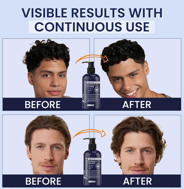 Biotin Hair Growth Conditioner for Hair Loss and Thinning Hair - 10.1 fl.oz