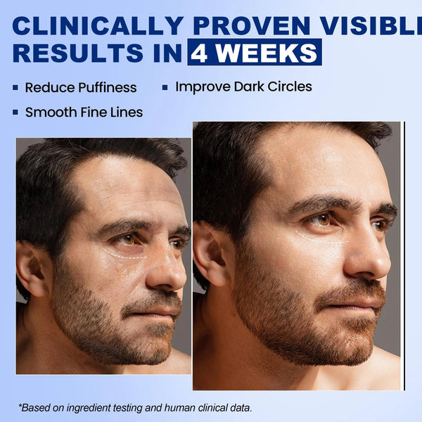 Uttse Anti-aging Eye Cream for Men