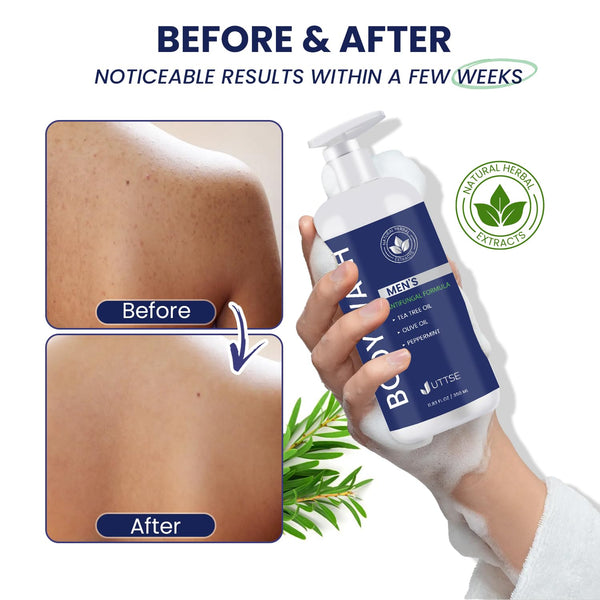 Tea Tree Body Wash: Antifungal Soap for Men 11.8fl oz/350mL