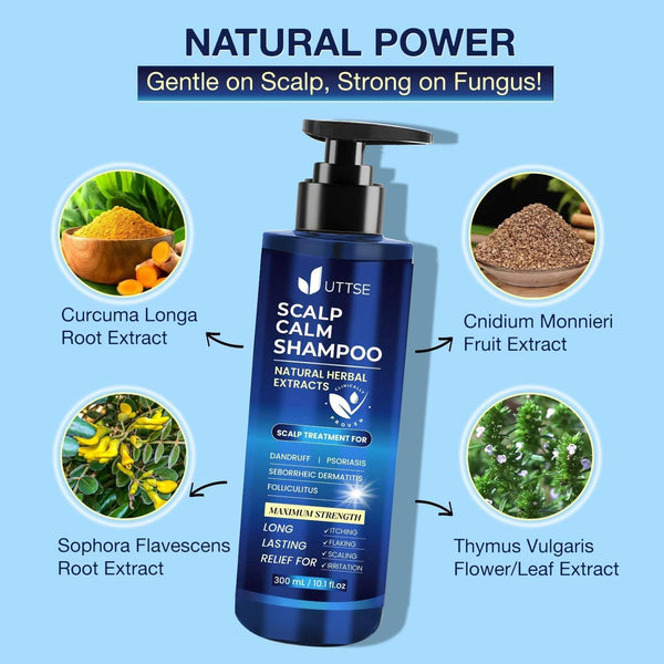 Scalp Calm Shampoo for Scalp Psoriasis
