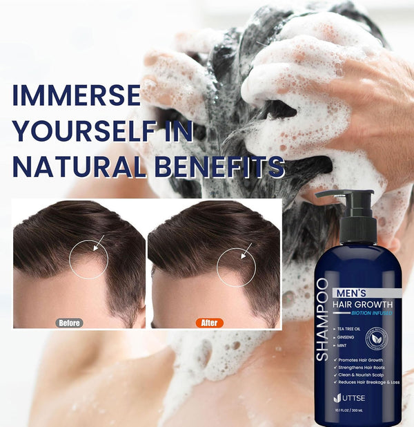 Biotion Hair Growth Shampoo for Hair Loss and Thinning Hair - 10.1 fl.oz